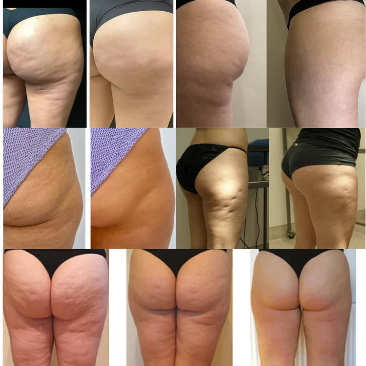 Crème anti-cellulite Ikenova