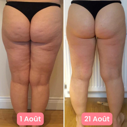 Crème anti-cellulite Ikenova